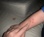 3 Signs of Bed Bugs in Your Child